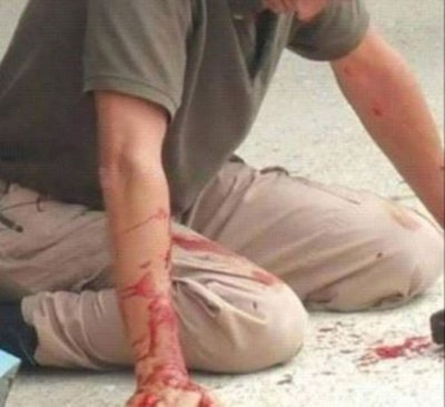 Birmingham detective bloodied and on his knees after attack by ex-con. (Photo: Facebook)