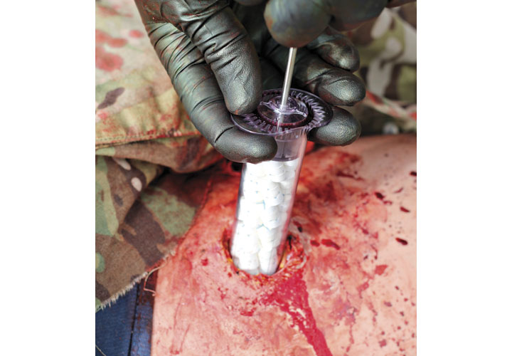 Injecting XSTAT's large syringe of sponges into a severe wound stops hemorrhaging within 15 to 20 seconds. (Photo: RevMedx)