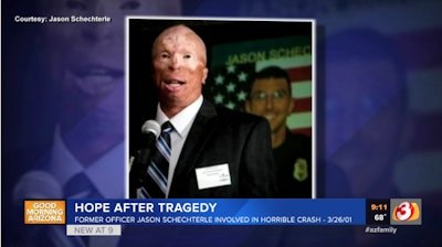 Former Phoenix officer Jason Schechterle was burned in a patrol car accident 18 years ago. Today, he continues his service by working with an area hospice. (Photo: AZ Family Screen Shot)