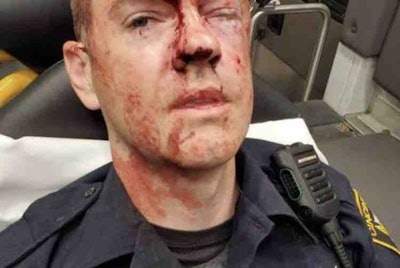 Photo of a Cincinnati officer beaten during a disorderly conduct arrest at an area YMCA. (Photo: FOP)