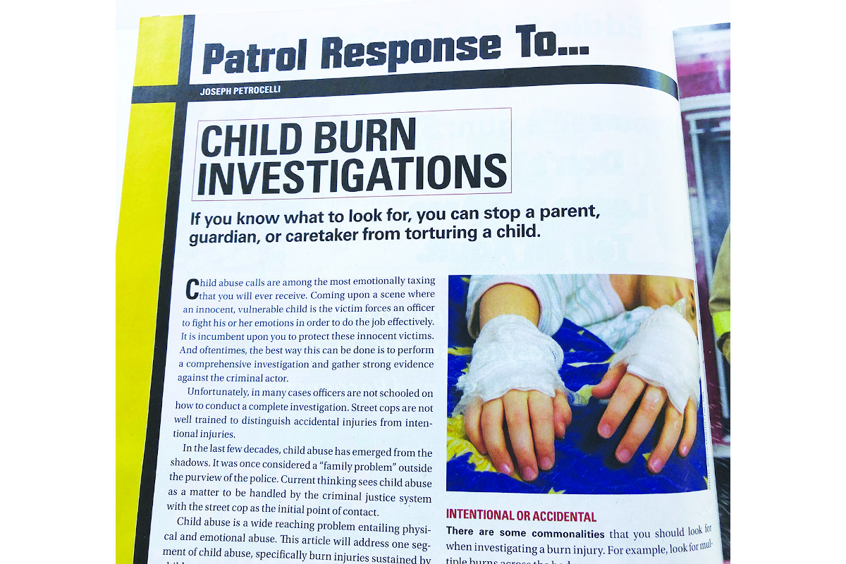 Patrol Response To…Child Burn Investigations