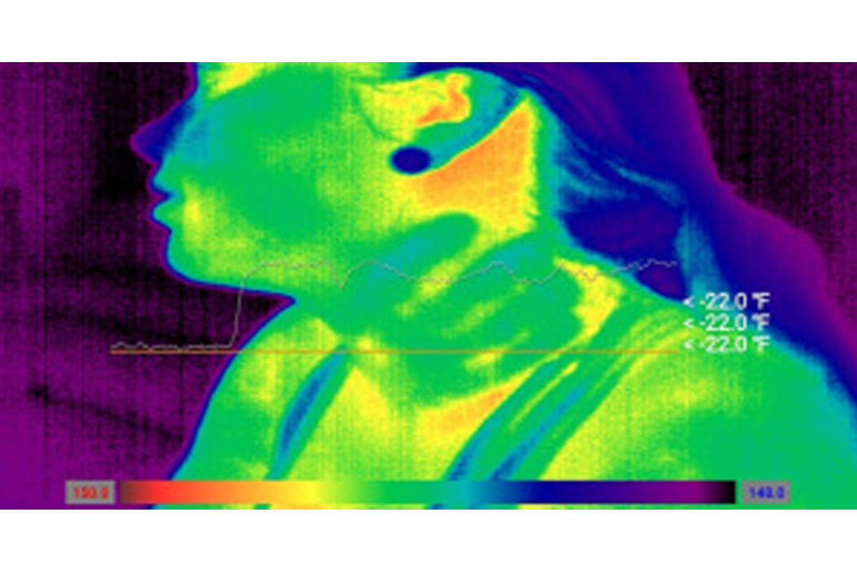 This thermal imaging camera uses infrared thermography to show a clear handprint around the victim's throat, indicating attempted strangulation.