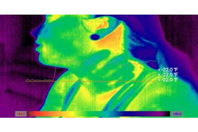 This thermal imaging camera uses infrared thermography to show a clear handprint around the victim's throat, indicating attempted strangulation.