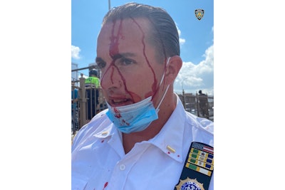 Multiple NYPD officers were badly injured in a protest attack Wednesday. (NYPD/Twitter)