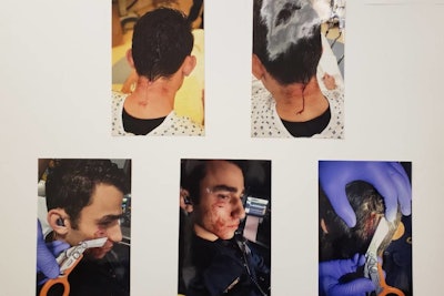 Photos released by police of the injuries sustained by Officer Christopher Flores after being attacked by Jamaica Hampton (Photo: SFPD)