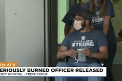Ste. Genevieve, MO, police Officer Pete Unverferth, who was severely burned in a Molotov cocktail attack two weeks ago, was released from a St. Louis hospital Monday. (Photo: KMOV Screen Shot)