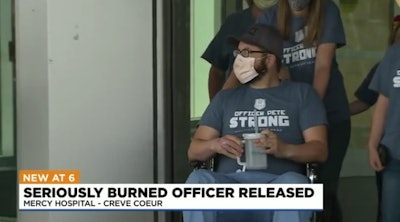 Ste. Genevieve, MO, police Officer Pete Unverferth, who was severely burned in a Molotov cocktail attack two weeks ago, was released from a St. Louis hospital Monday. (Photo: KMOV Screen Shot)